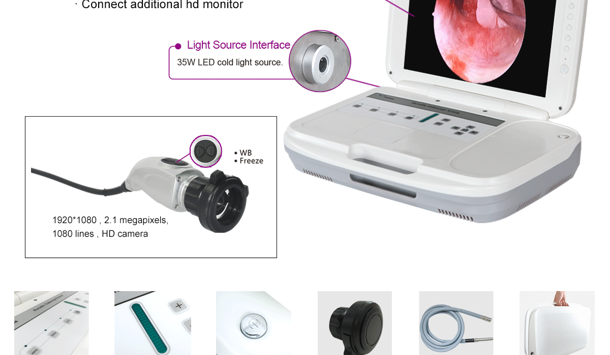 HD endoskopische Kamera